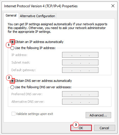 click on Obtain an IP address automatically and Obtain DNS server address automatically in tcp properties